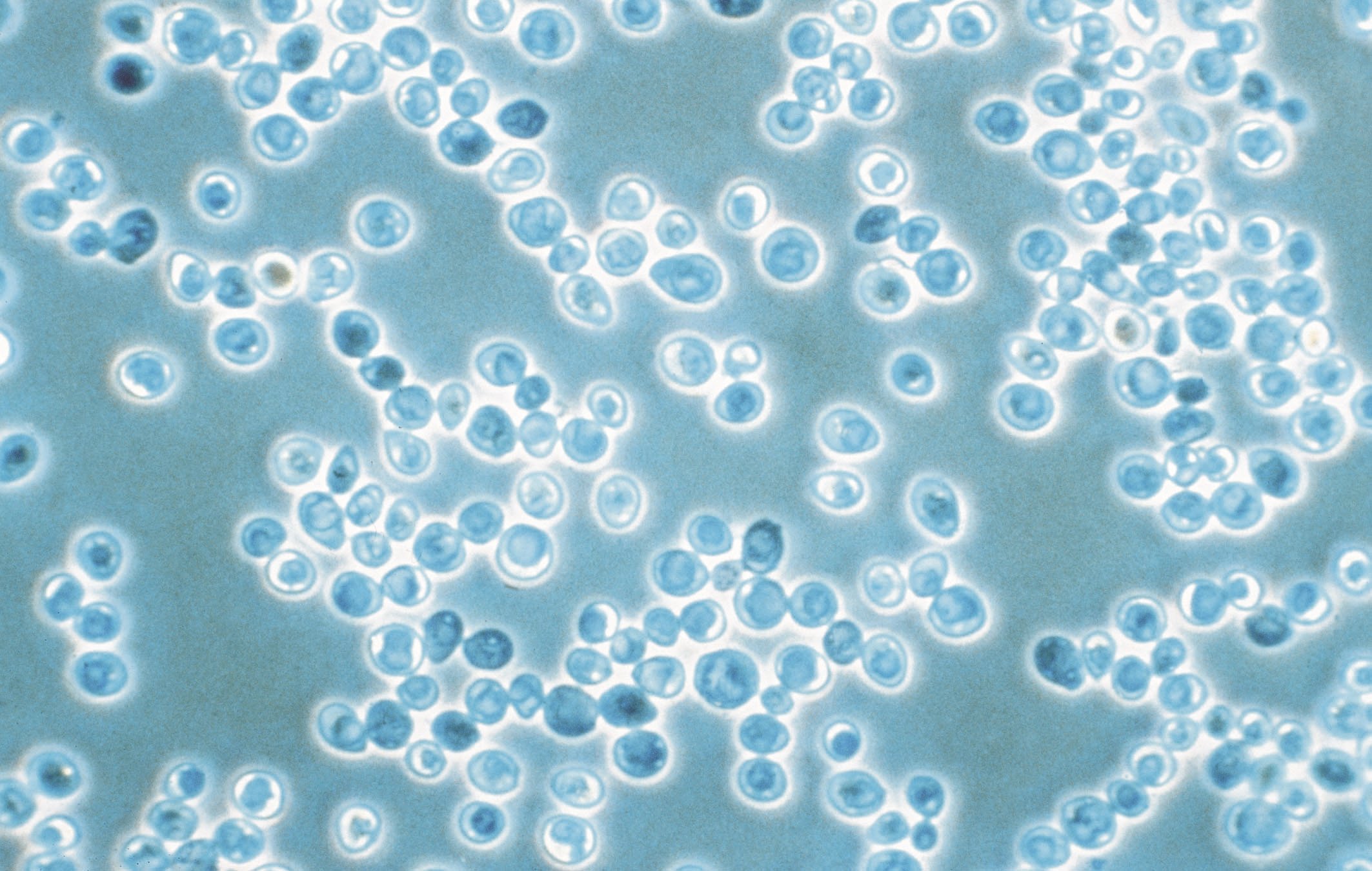 beer yeast strains for beer fermentation